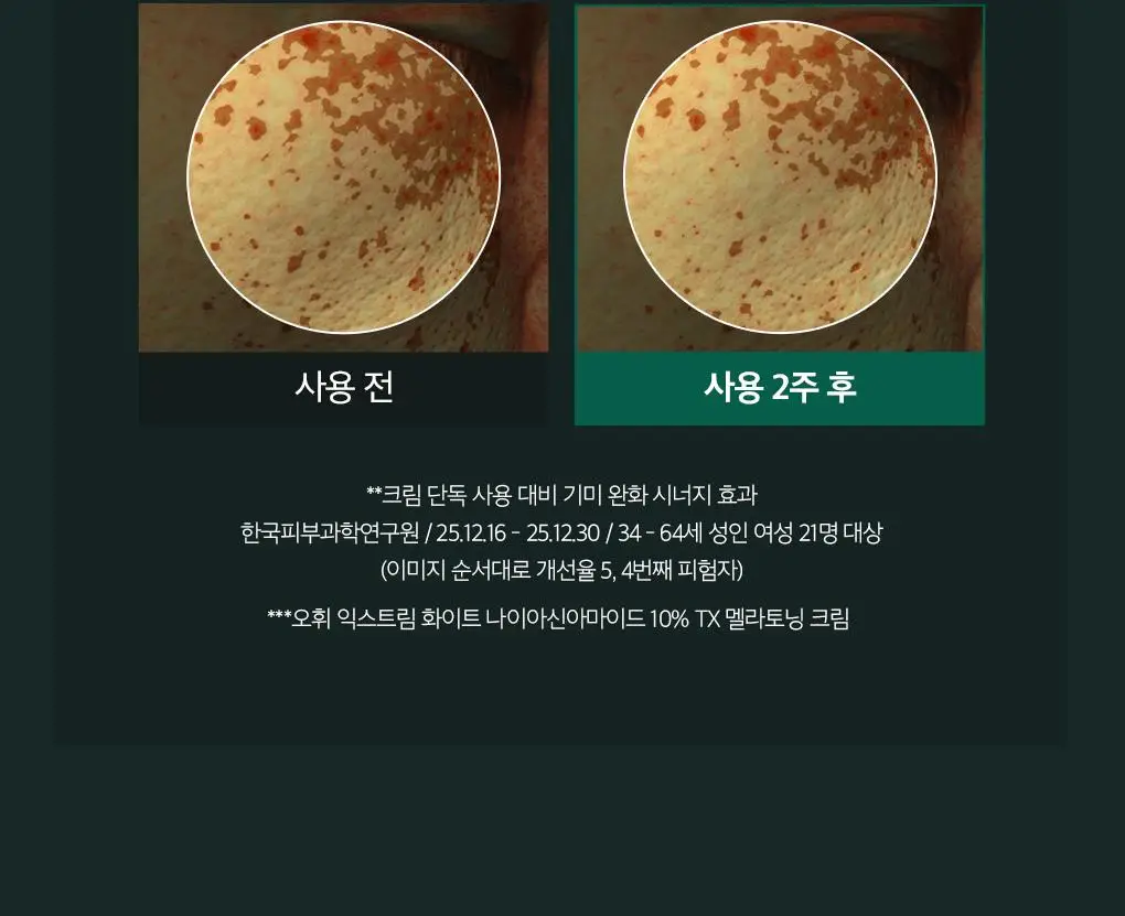 [이달의신상] 오휘 기미케어 3-STEP 콜라겐 톤업선 50ml / 데니어 팩트 리필 기획 / 멜라토닝 크림 60ml 상세페이지 66